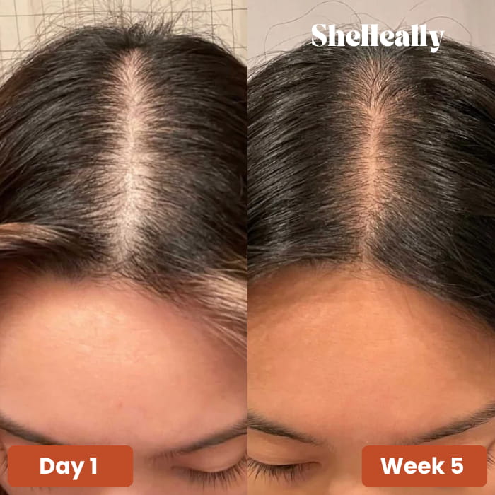 Pumpkin Seed Oil Softgels - SheHeally