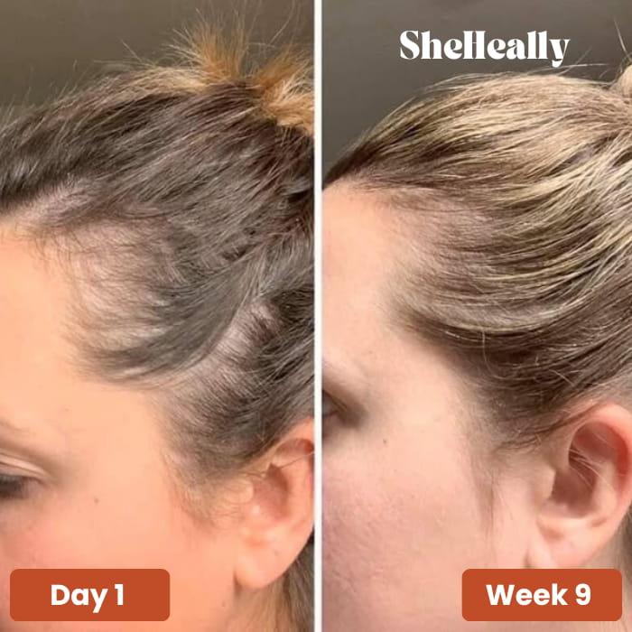 Pumpkin Seed Oil Softgels - SheHeally