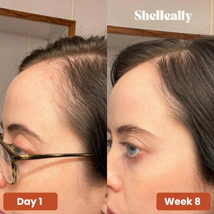 Pumpkin Seed Oil Softgels - SheHeally